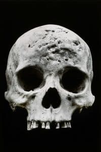 Learning from Medical Photography Collecting