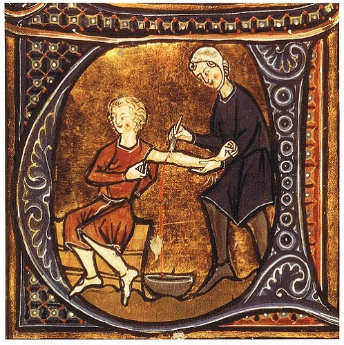Bloodletting Instruments and Methods